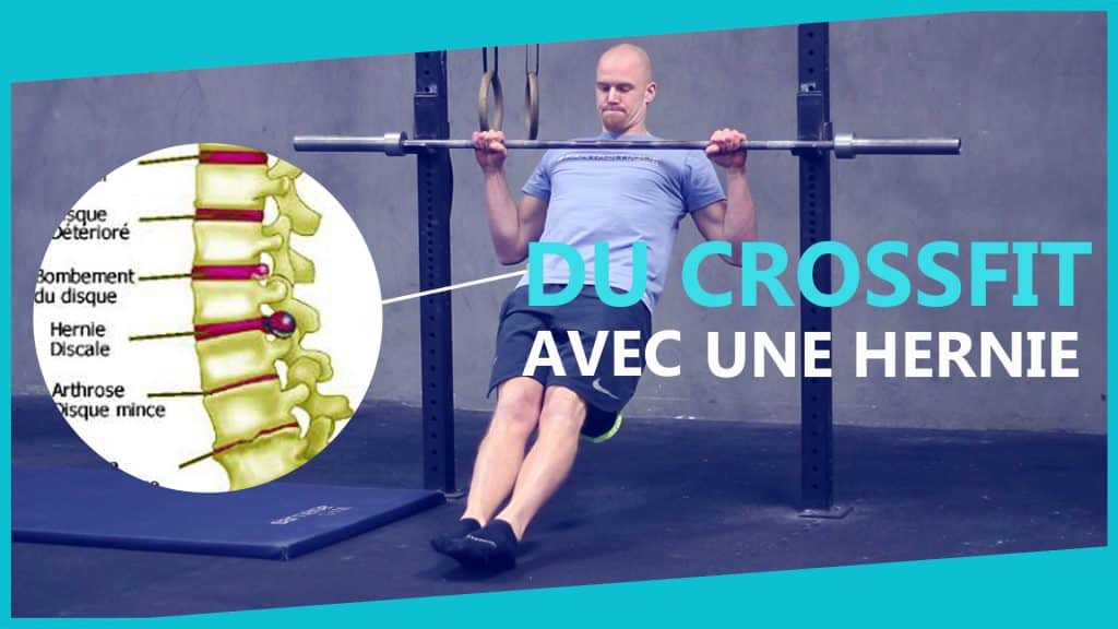 Hernie discale - CrossFit